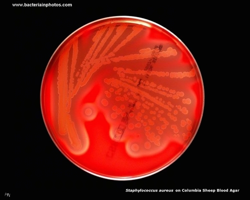 staphylococcus on blood agar